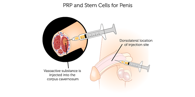A close-up of a syringe

AI-generated content may be incorrect.