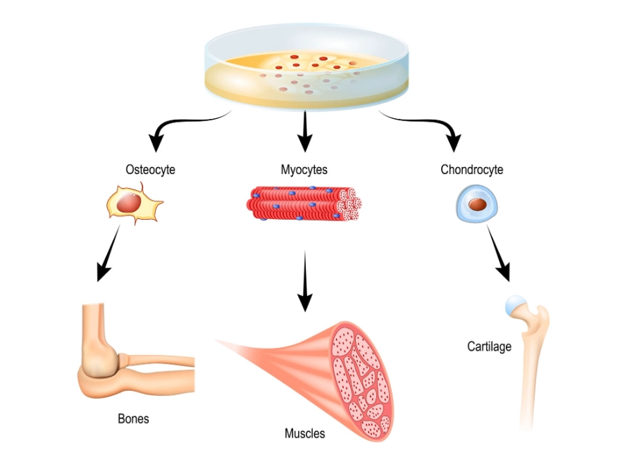 Mesenchymal Stem Cell