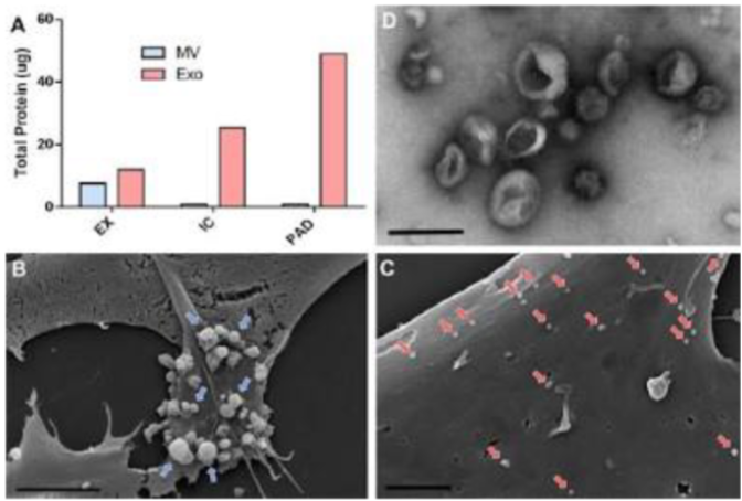 Mesenchymal Stem Cell